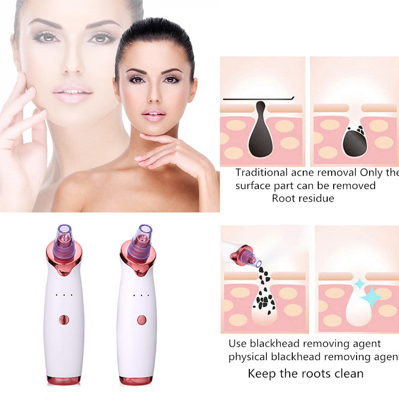 Vacuum Suction for Blackhead Remover & Pore Cleaning (Ships USA Only)